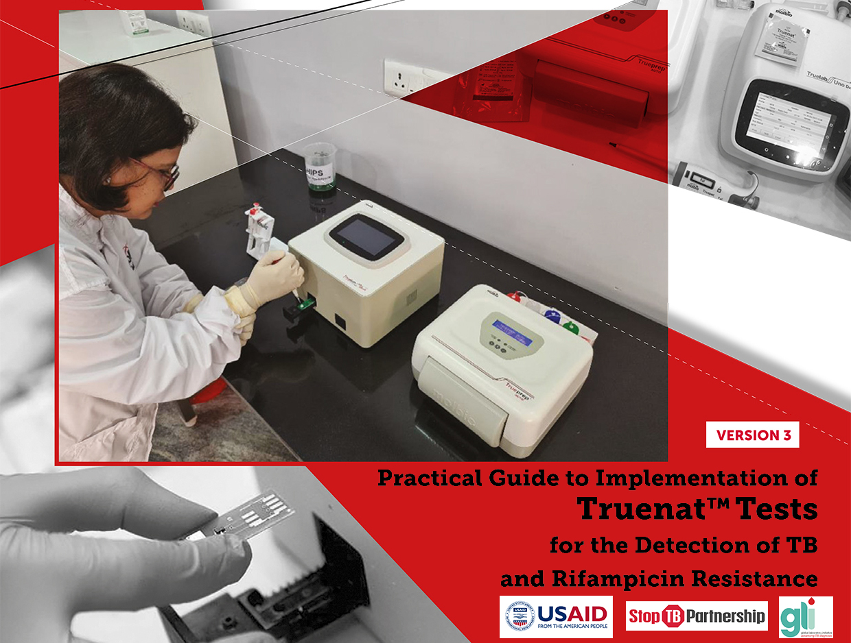 Practical Guide to Implementation of Truenat Tests