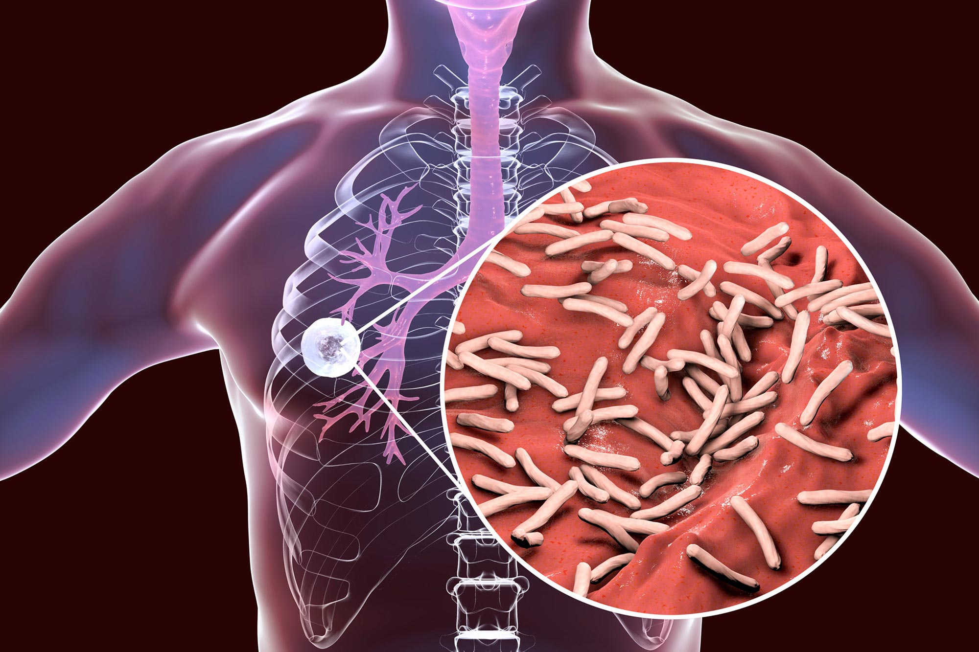 August 2025 LabCoP Extended ECHO: Accelarating TB Diagnostic in Africa